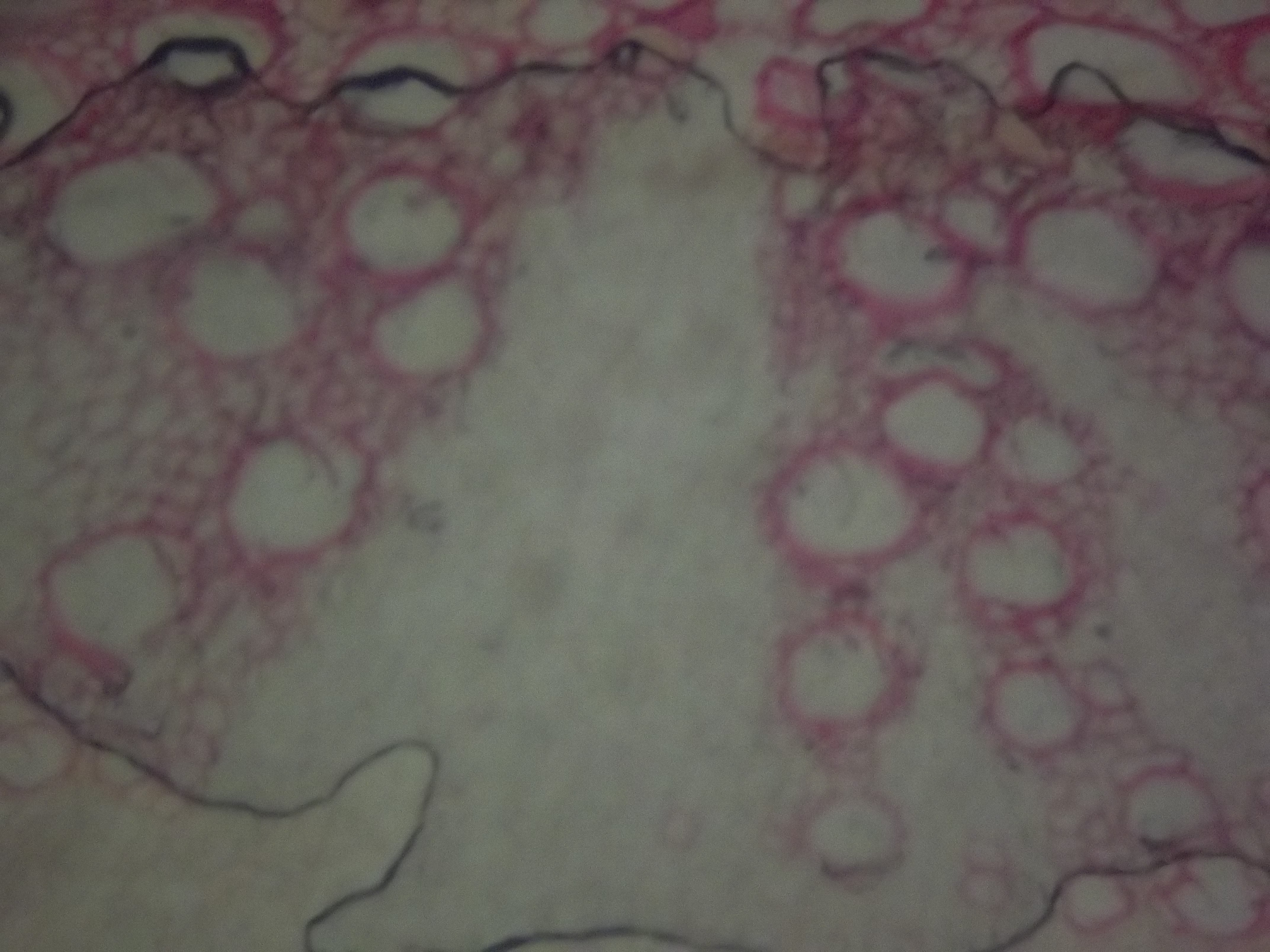 Lâmina de Flor de Crisântemo, Corada com Fucsina. Aumento, 640 vezes.
